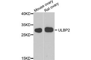 Western blot analysis of extracts of various cell lines, using ULBP2 antibody (ABIN5974540) at 1/1000 dilution. (ULBP2 Antikörper)