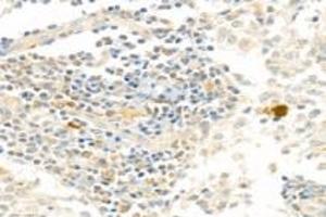 Immunohistochemistry analysis of paraffin-embedded human lymph node using PARP1 (ABIN7075114) at dilution of 1: 750 (PARP1 Antikörper  (cleaved))