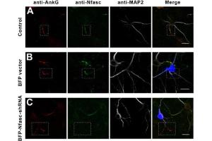 Immunostaining of mouse WT neurons (A) or neurons transfected with BFP vector (B), or BFP-Nfasc-shRNA (C) and stained for AnkG (red), Nfasc (green), and MAP2 (white). (Ankyrin G Antikörper)