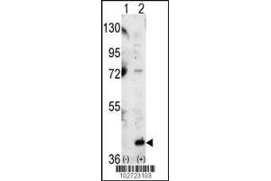 Western blot analysis of P38 using P38 Antibody using 293 cell lysates (2 ug/lane) either nontransfected (Lane 1) or transiently transfected with the MAPK14 gene (Lane 2).