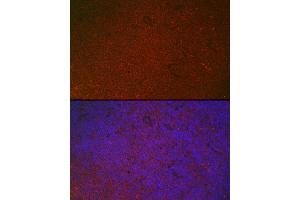 Immunofluorescence (IF) image for anti-Fc Fragment of IgG, Low Affinity IIa, Receptor (CD32) (FCGR2A) (AA 34-316) antibody (ABIN1512904)