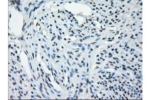 Immunohistochemical staining of paraffin-embedded Kidney tissue using anti-AURKCmouse monoclonal antibody. (Aurora Kinase C Antikörper)