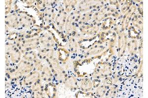ABIN6257793 and ABIN6276233 at 1/100 staining Rat kidney tissue by IHC-P. (AVPR2 Antikörper  (Internal Region))