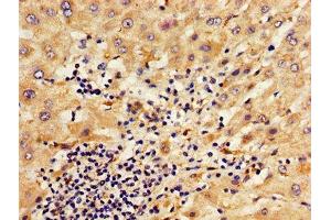 Immunohistochemistry (IHC) image for anti-serpin Peptidase Inhibitor, Clade A (Alpha-1 Antiproteinase, Antitrypsin), Member 6 (SERPINA6) (AA 23-405) antibody (ABIN7148621)