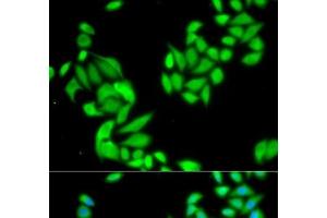 Immunofluorescence analysis of HeLa cells using IKK beta Polyclonal Antibody (IKBKB Antikörper)
