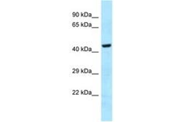 GHDC Antikörper  (AA 70-119)