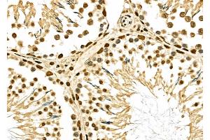 ABIN6264499 and ABIN6276907 at 1/100 staining Rat testis tissue by IHC-P. (PTBP1 Antikörper  (N-Term))