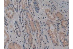 DAB staining on IHC-P; Samples: Human Kidney Tissue (NOSIP Antikörper  (AA 62-295))
