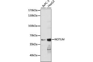 Western blot analysis of extracts of various cell lines, using NOTUM antibody (ABIN7268961) at 1:1000 dilution. (NOTUM Antikörper  (AA 20-320))