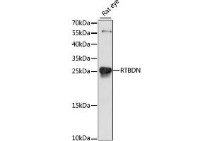 Western blot analysis of extracts of rat eye, using RTBDN antibody. (Retbindin Antikörper)