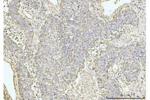 IHC analysis of GRPEL1 using anti-GRPEL1 antibody (ABIN7602643).