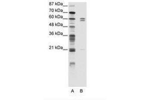 Image no. 1 for anti-FEZ Family Zinc Finger 2 (FEZF2) (C-Term) antibody (ABIN203150) (FEZF2 Antikörper  (C-Term))