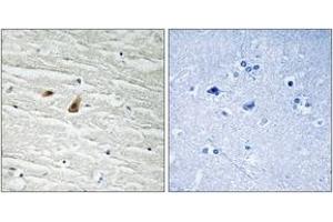 Immunohistochemistry analysis of paraffin-embedded human brain, using C/EBP-epsilon (Phospho-Thr74) Antibody. (CEBPE Antikörper  (pThr74))