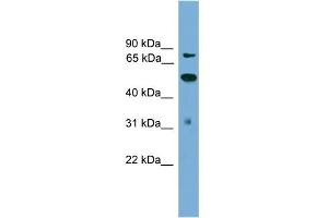 WB Suggested Anti-TLK2 Antibody Titration: 0.