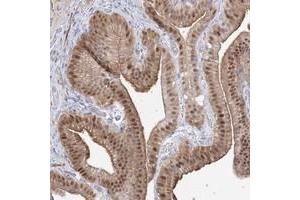 Immunohistochemical staining of human gallbladder with ARHGAP21 polyclonal antibody  shows distinct nuclear and cytoplasmic positivity in glandular cells at 1:200-1:500 dilution. (ARHGAP21 Antikörper)