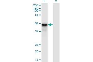 Western Blot analysis of PYGO1 expression in transfected 293T cell line by PYGO1 monoclonal antibody (M13), clone 3E1.