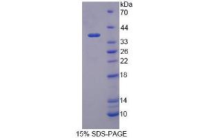 SDS-PAGE analysis of Human TIF1b Protein. (KAP1 Protein)