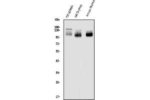 Western blot analysis of SELPLG using anti-SELPLG antibody (ABIN7600337).
