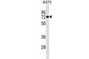 Western Blotting (WB) image for anti-Podocan (PODN) antibody (ABIN3001059) (Podocan Antikörper)