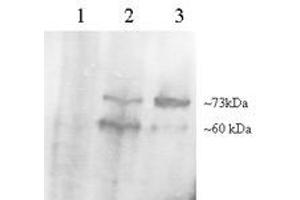 Image no. 1 for anti-Proprotein Convertase Subtilisin/kexin Type 9 (PCSK9) (C-Term) antibody (ABIN374535) (PCSK9 Antikörper  (C-Term))