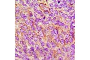 Immunohistochemistry (IHC) image for anti-Leukocyte Immunoglobulin-Like Receptor, Subfamily B (With TM and ITIM Domains), Member 5 (LILRB5) antibody (ABIN7303534)