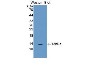 Western blot analysis of the recombinant protein. (SLIT3 Antikörper  (AA 1449-1523))