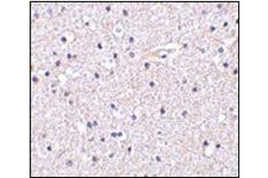 Immunohistochemistry of Nicastrin in human brain tissue with this product at 5 μg/ml. (Nicastrin Antikörper  (C-Term))