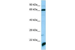 WB Suggested Anti-ATAD3A Antibody Titration: 1. (ATAD3A Antikörper  (C-Term))
