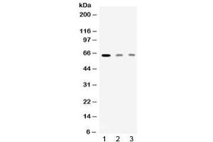 Western blot testing of 1) rat skeletal muscle, 2) human HeLa and 3) human MCF7 lysate with AMHR2 antibody at 0. (AMHR2 Antikörper)