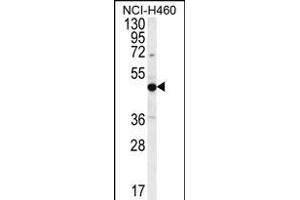 PREF8 Antibody (C-term) (ABIN656145 and ABIN2845481) western blot analysis in NCI- cell line lysates (35 μg/lane). (PRAMEF8 Antikörper  (C-Term))