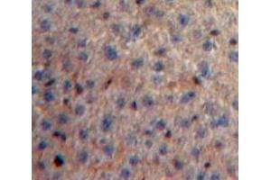 Used in DAB staining on fromalin fixed paraffin-embedded Liver tissue (SAA4 Antikörper  (AA 19-130))