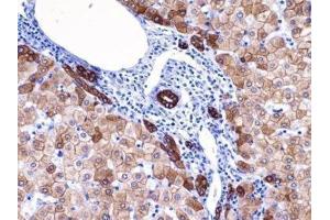 Immunohistochemistry (IHC) image for anti-Keratin 18 (KRT18) (C-Term) antibody (ABIN870573) (Cytokeratin 18 Antikörper  (C-Term))