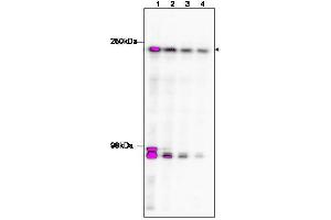 Western Blotting (WB) image for anti-TAF1 RNA Polymerase II, TATA Box Binding Protein (TBP)-Associated Factor, 250kDa (TAF1) (C-Term) antibody (ABIN233826) (TAF1 Antikörper  (C-Term))