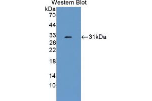 Western blot analysis of the recombinant protein. (Complement Factor I Antikörper  (AA 358-603))