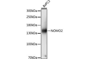 Western blot analysis of extracts of BxPC3 cells, using NOMO2 antibody (ABIN7268943) at 1:1000 dilution. (NOMO2 Antikörper  (AA 873-1222))