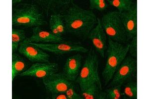 IF analysis of U1A/SNRPA and Tubulin beta using anti-U1A/SNRPA antibody (ABIN7600891) and anti-Tubulin beta antibody (ABIN7602744). (SNRPA1 Antikörper  (AA 25-218))