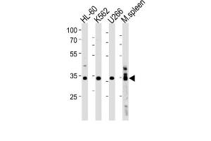 Western Blotting (WB) image for anti-Growth Factor Independent 1B Transcription Repressor (GFI1B) antibody (ABIN3004598) (GFI1B Antikörper)