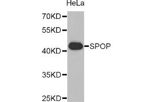Western blot analysis of extracts of HeLa cell line, using SPOP antibody. (SPOP-B Antikörper)