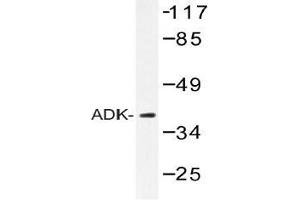 Western blot (WB) analysis of ADK antibody in extracts from RAW264. (ADK Antikörper)
