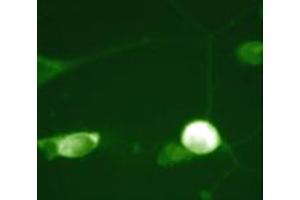 Immunocytochemical labeling in chick dorsal root ganglion neurons using CFL1 polyclonal antibody  . (Cofilin Antikörper  (N-Term))
