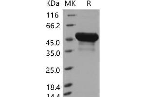 Western Blotting (WB) image for Bleomycin Hydrolase (BLMH) (Active) protein (His tag) (ABIN7194397)