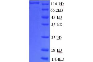 SDS-PAGE (SDS) image for phosphorylase, Glycogen, Liver (PYGL) (AA 2-846), (partial) protein (GST tag) (ABIN5710195) (PYGL Protein (AA 2-846, partial) (GST tag))