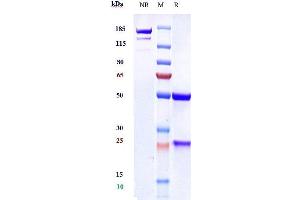 Anti-VEGFC Reference Antibody (VGX100) on SDS-PAGE under reducing (R) condition. (Rekombinanter VEGFC Antikörper)