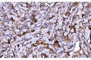 IHC analysis of HGS using anti-HGS antibody (ABIN7601206). (HGS Antikörper  (AA 3-777))