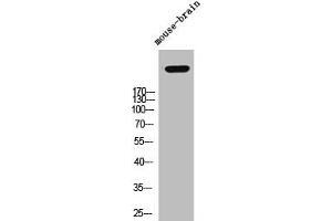 Western Blot analysis of mouse-brain cells using Versican Polyclonal Antibody (Versican Antikörper  (N-Term))