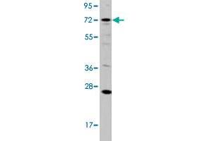 Western blot analysis of HL-60 cell lysate (35 ug/lane) with DGKA polyclonal antibody . (DGKA Antikörper  (C-Term))