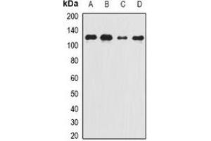Western blot analysis of Complement C5 expression in Raji (A), Jurkat (B), mouse heart (C), rat liver (D) whole cell lysates.