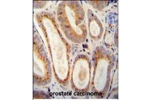 Immunohistochemistry (Paraffin-embedded Sections) (IHC (p)) image for anti-WAP Four-Disulfide Core Domain 12 (WFDC12) (AA 66-94), (C-Term) antibody (ABIN654327)