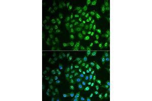 Immunofluorescence analysis of A549 cells using FAH antibody. (FAH Antikörper  (AA 1-419))