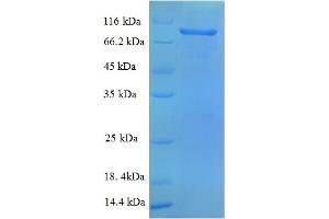 SDS-PAGE (SDS) image for Vascular Cell Adhesion Molecule 1 (VCAM1) (AA 31-697), (partial) protein (His tag) (ABIN5713050)